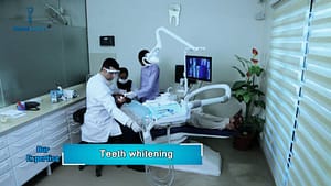 Teeth-Whitening-Treatment-in-Dental-Expert
